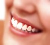 Исправление зубов без брекетов