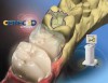 Состоялся республиканский семинар "Возможности 3D систем в стоматологии""